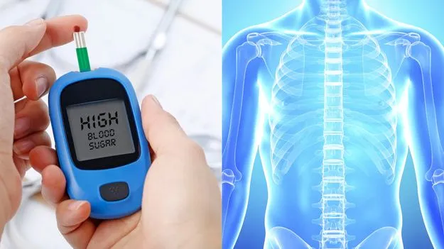 Diabetes Bone Health: డయాబెటిస్ వల్ల ఎముకలు బలహీనంగా మారుతాయా?