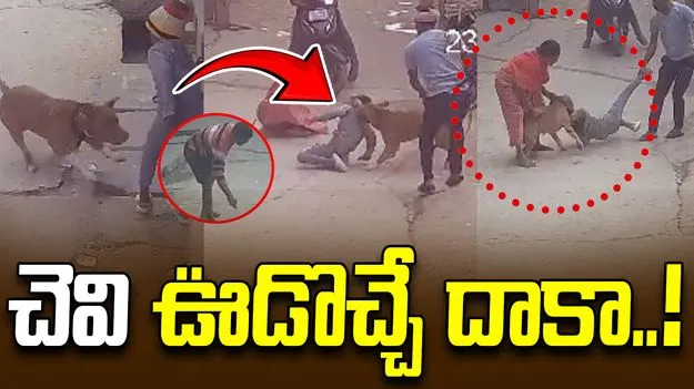 Dog attack on Boy: బాలుడిపై శునకం దాడి.. తెగిపడిన చెవి