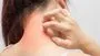 Vitamin Deficiency Causing Itching: ఈ విటమిన్ లోపం వల్ల శరీరంలో దురద వస్తుంది.!