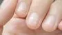 White Spots On Nails: గోళ్ళపై తెల్లటి మచ్చలు ఎందుకు వస్తాయో తెలుసా?