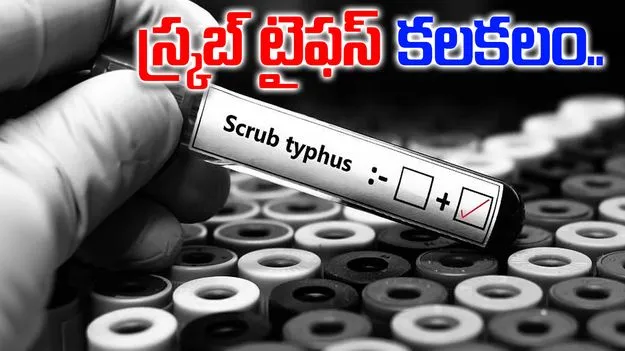 Palnadu Scrub Typhus: పల్నాడు జిల్లాలో స్క్రబ్ టైఫస్ కలకలం.. ఇద్దరు మృతి