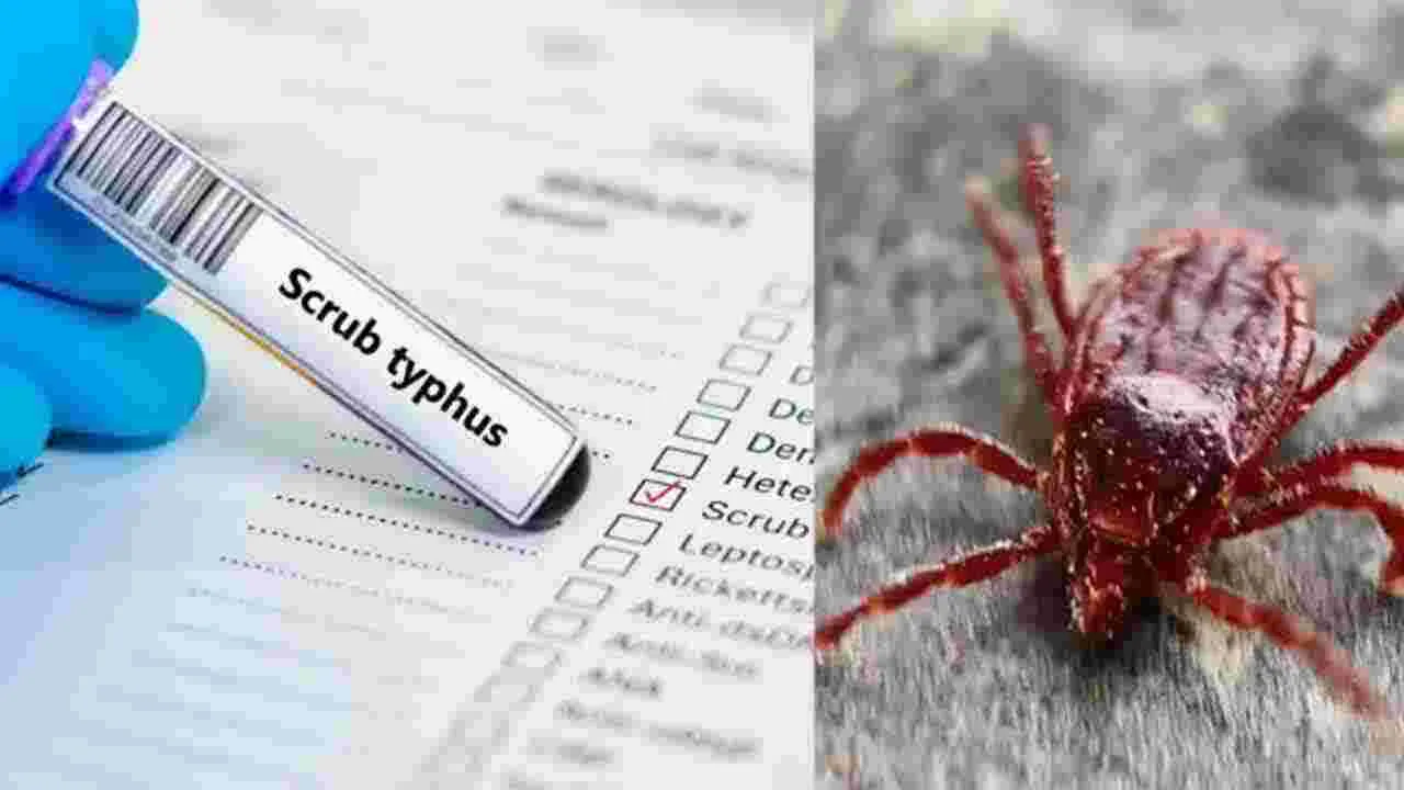 scrub Typhus: వామ్మో స్క్రబ్‌ టైఫస్‌