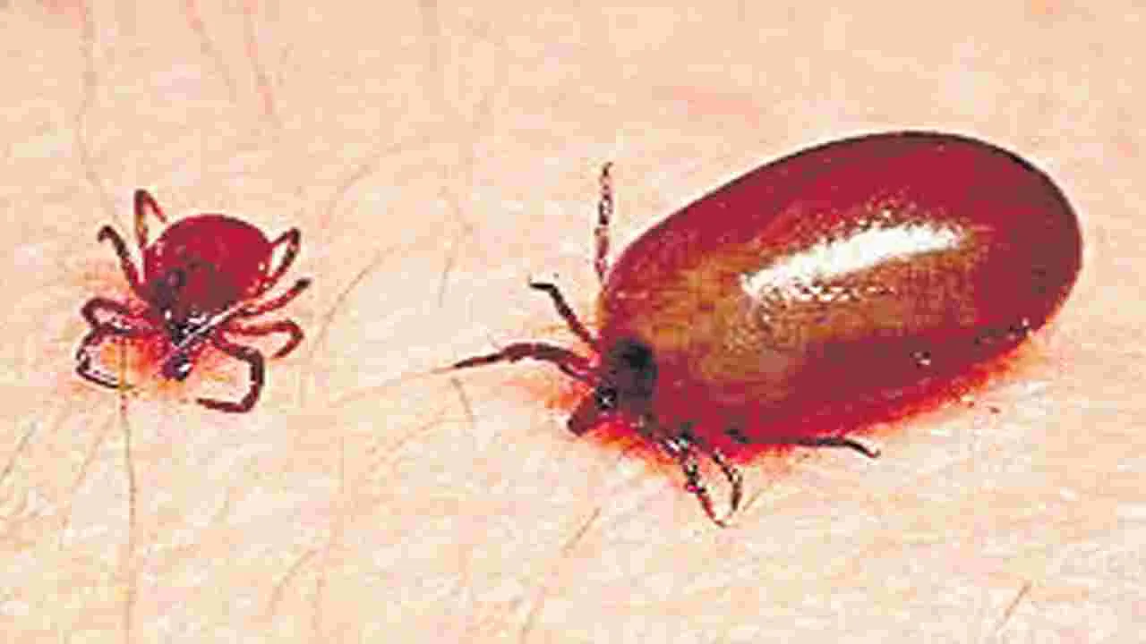 Health Department: 1,566 స్క్రబ్‌ టైఫస్‌ కేసులు