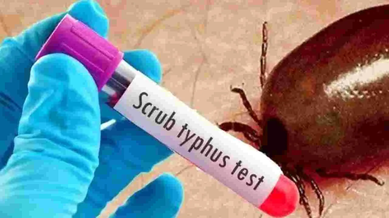 Guntur District: తెనాలిలో ఆరు స్క్రబ్‌ టైఫస్‌ కేసులు