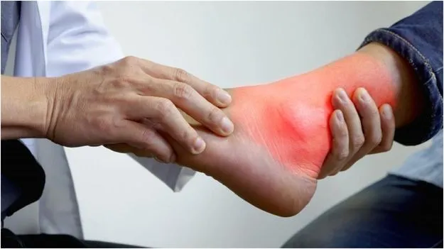 Causes of High Uric Acid: శరీరంలో యూరిక్ యాసిడ్ పెరిగితే ఏం జరుగుతుందో తెలుసా? 