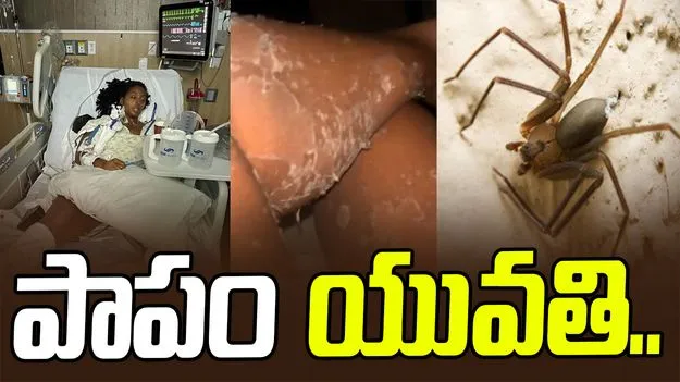 Terrifying Spider Bite: సాలెపురుగు ఎంత పని చేసింది.. ఆ విషం కారణంగా.. 