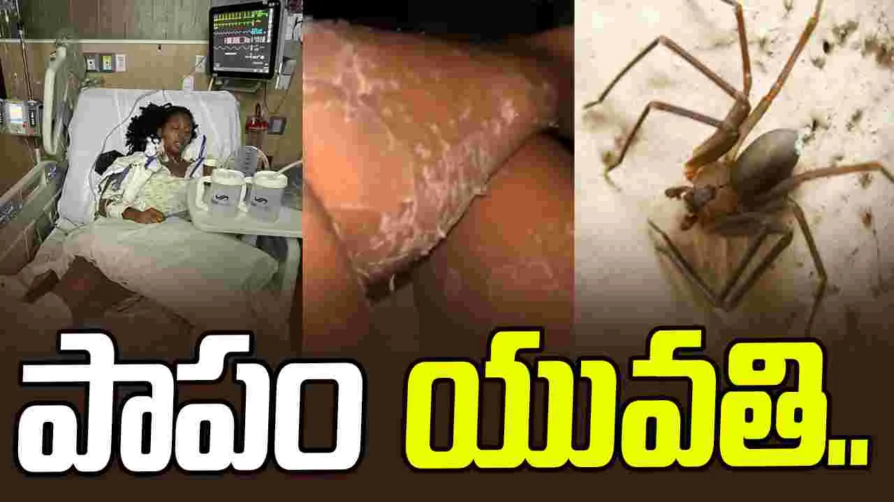 Terrifying Spider Bite: సాలెపురుగు ఎంత పని చేసింది.. ఆ విషం కారణంగా..