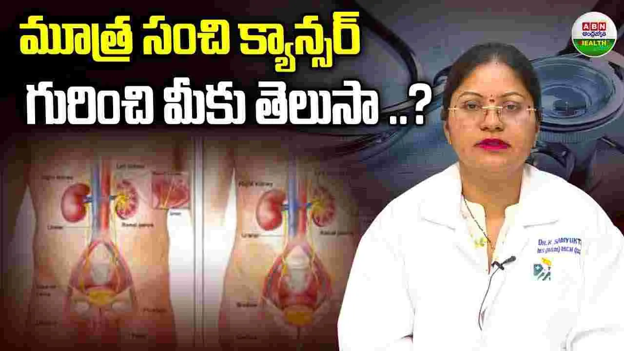 మూత్రాశయ క్యాన్సర్ గురించి మీకు తెలుసా..