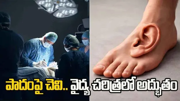 China medical miracle: వైద్య ప్రపంచంలోనే అద్భుతం.. పాదం మీద చెవి పెట్టి కాపాడారు..