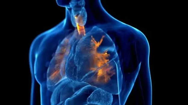 Health: సన్నబడిన శ్వాసనాళానికి చికిత్స..