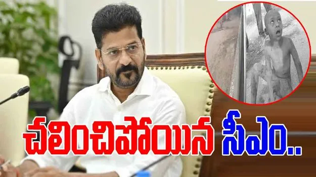 CM Reventh reddy: వీధి కుక్కల దాడిలో గాయపడిన బాలుడు.. స్పందించిన సీఎం