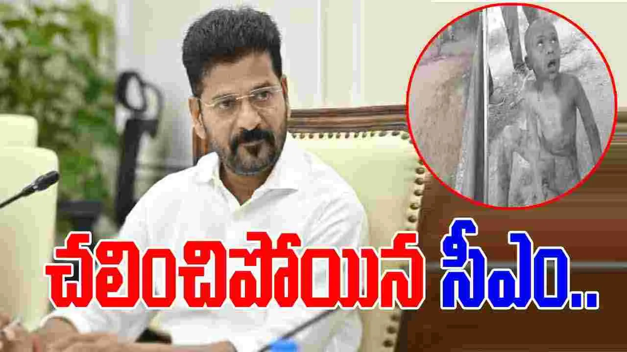 CM Reventh reddy: వీధి కుక్కల దాడిలో గాయపడిన బాలుడు.. స్పందించిన సీఎం