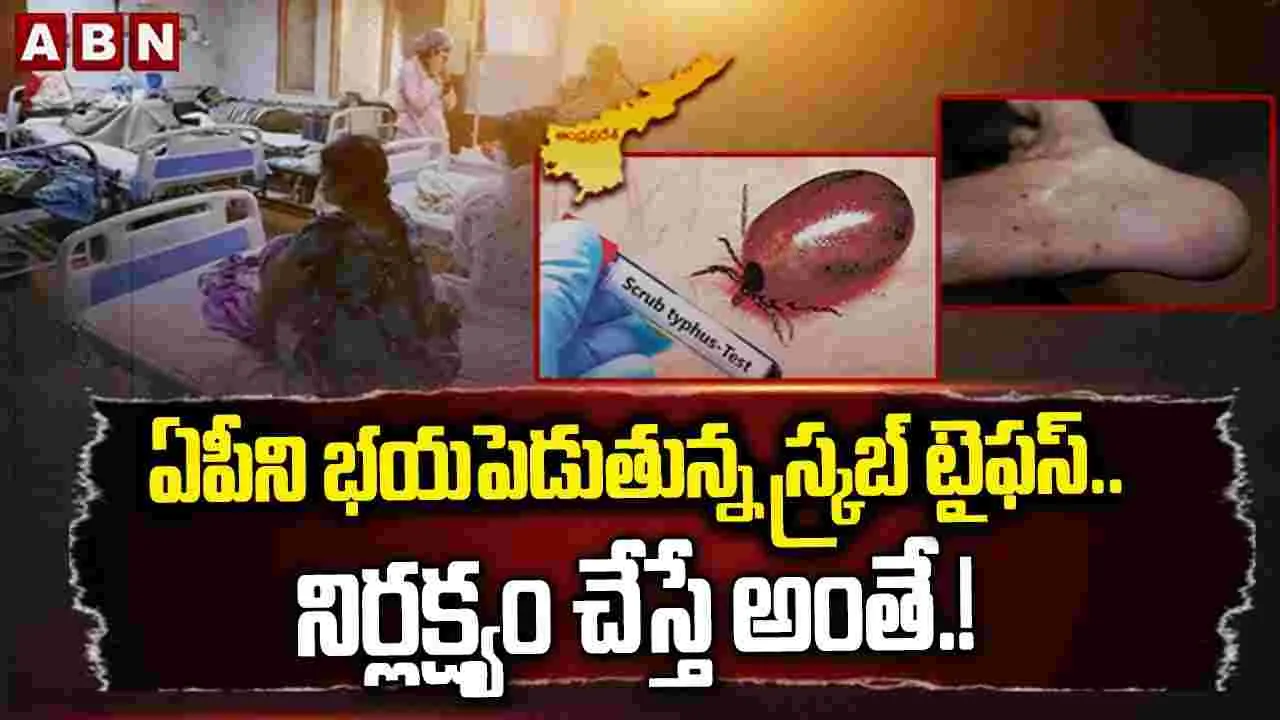 ఏపీని భయపెడుతున్న స్క్రబ్ టైఫస్..నిర్లక్ష్యం చేస్తే అంతే.!
