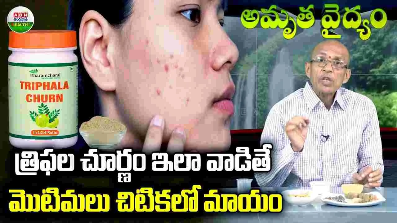 త్రిఫల చూర్ణం.. వాడితే మొటిమలు చిటికలో మాయం