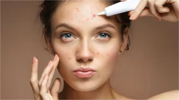 Facial Skin care Tips: ముఖంపై నల్లటి మచ్చలు.. ఈ చిట్కాతో సమస్యకు చెక్