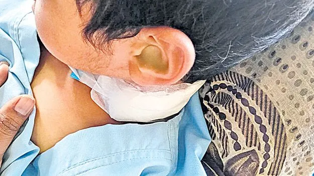 China Manja Strangles: మెడలు కొసేస్తున్న చైనా మాంజా