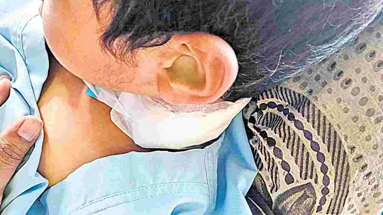 China Manja Strangles: మెడలు కొసేస్తున్న చైనా మాంజా