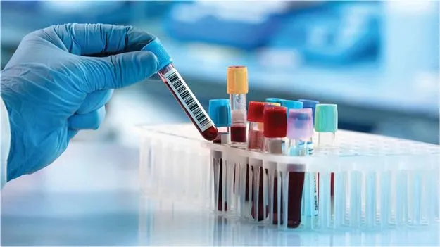 Winter Blood Tests: శీతాకాలంలో తప్పనిసరిగా చేయించుకోవాల్సిన రక్త పరీక్షలు