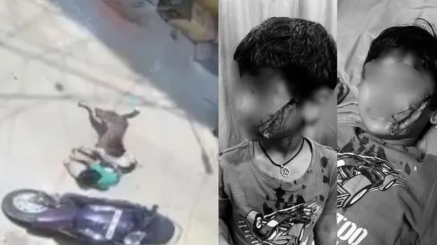 ఇంటి ముందు ఆడుకుంటున్న చిన్నారిపై వీధి కుక్క దాడి