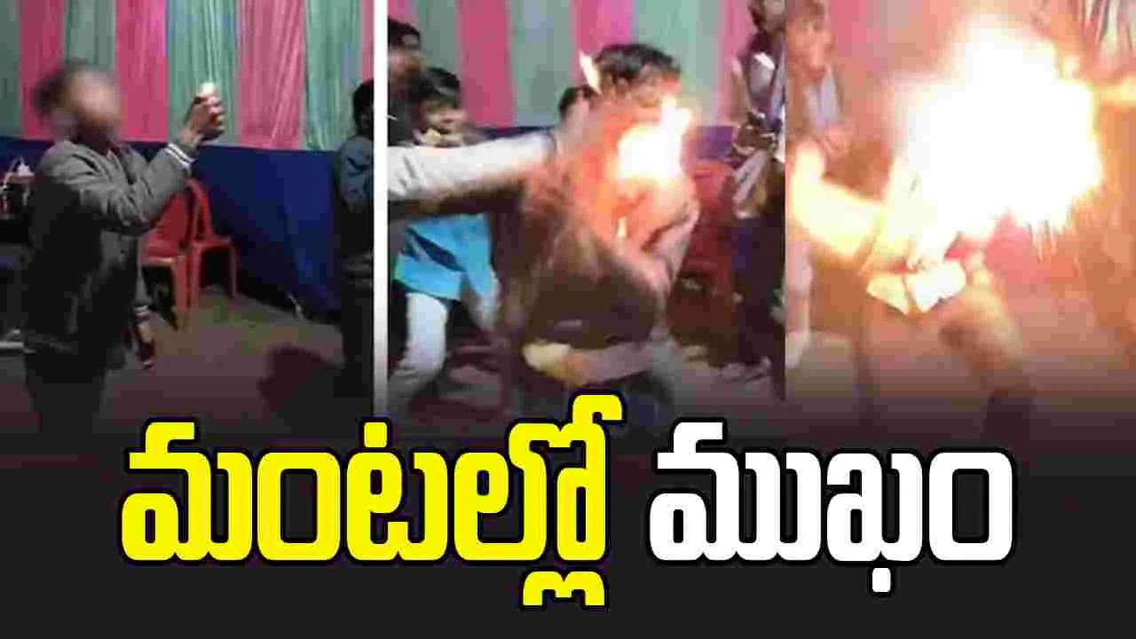 కొంపముంచిన రీల్స్ పిచ్చి.. మూతి కాలిపోయిందిగా..