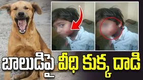 ఐదేళ్ల బాలుడిపై వీధి కుక్క దాడి.. వీడియో వైరల్