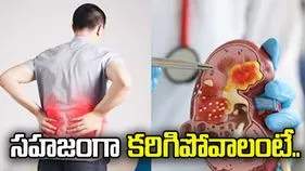 కిడ్నీ స్టోన్స్ సహజంగా కరిగిపోవాలంటే ఏం చేయాలి?