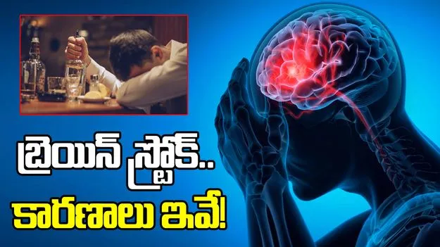 బ్రెయిన్ స్ట్రోక్.. కారణాలు ఇవే!