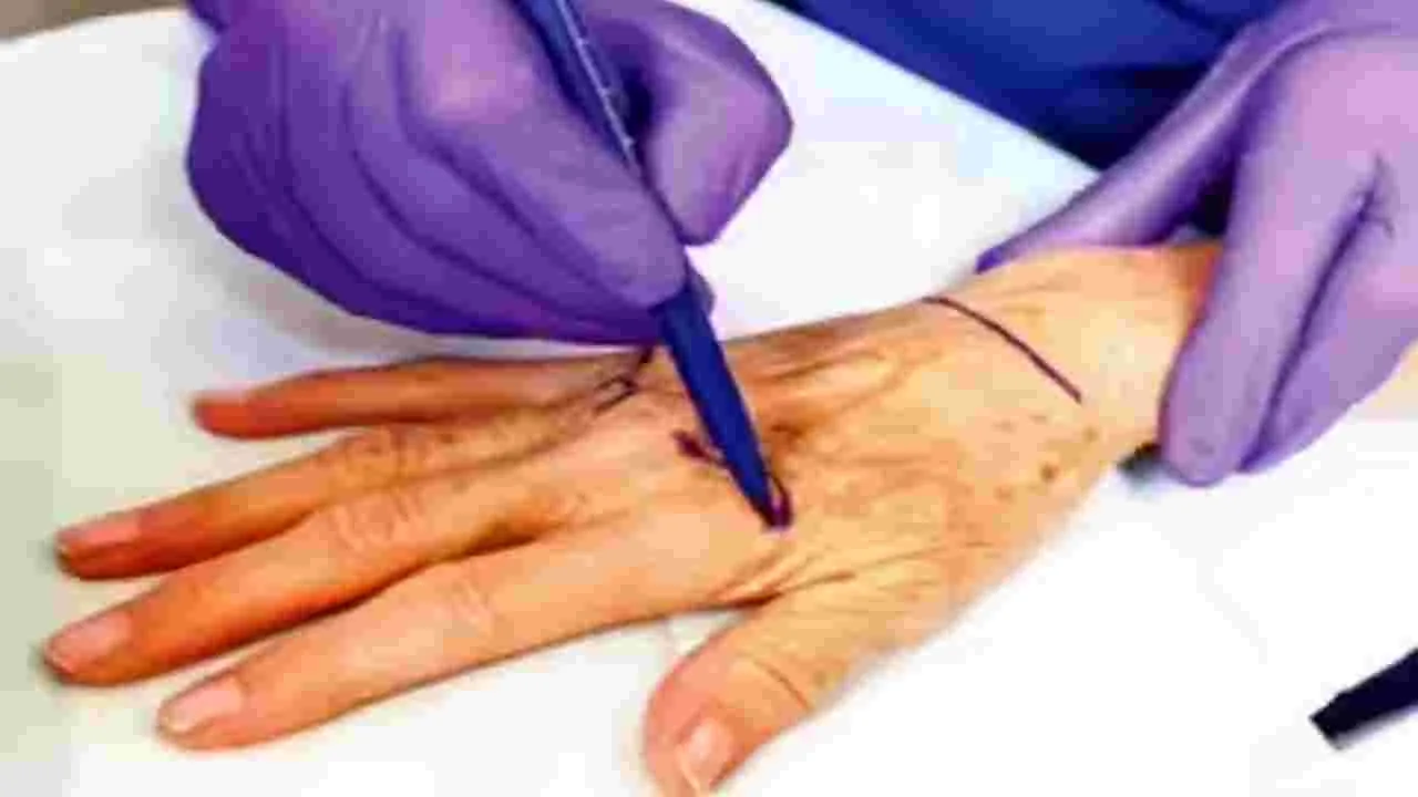 రాష్ట్రంలోనూ చేతుల మార్పిడి ఆపరేషన్లు