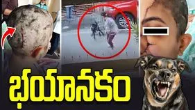 పెంపుడు కుక్క దాడి.. మహిళకు 50 కుట్లు.. సీసీటీవీలో భయానక దృశ్యాలు!