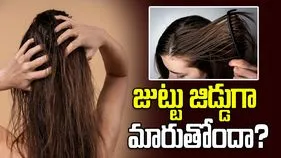 తలస్నానం చేసిన రెండో రోజే మీ జుట్టు జిడ్డుగా మారుతోందా?