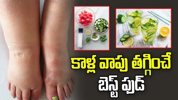 కాళ్ల వాపు వస్తే తగ్గడానికి ఎలాంటి ఆహారం తీసుకోవాలి..