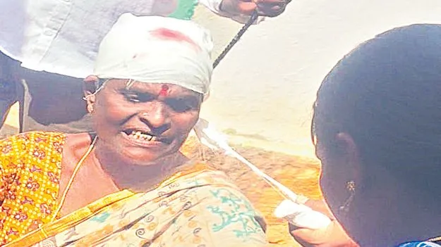 పైకప్పు పెచ్చులూడి.. మహిళకు గాయాలు 