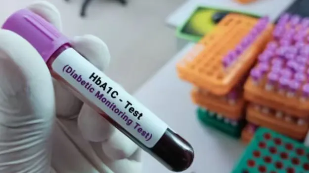 కేవలం హెచ్‌బీఏ1సీ పరీక్షపైనే ఆధారపడొద్దు!