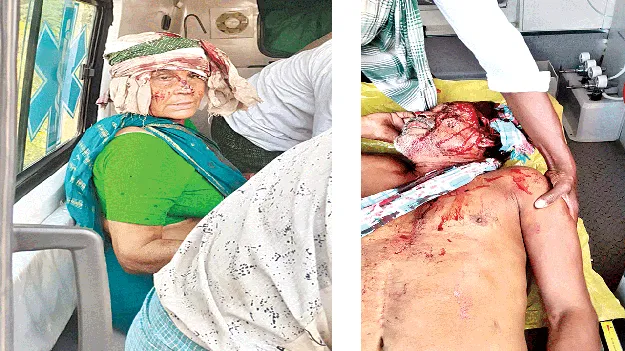 వృద్ధ దంపతులపై దాడి.. తీవ్ర గాయాలు