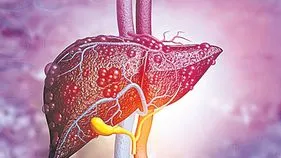 ఫ్యాటీ లివర్‌తో పరేషాన్‌