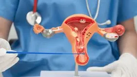 సర్వైకల్‌ క్యాన్సర్‌పై పోరు