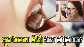 జ్ఞాన దంతాలు తొలగిస్తే చూపు తగ్గుతుందా? నిపుణులు ఏమంటున్నారంటే.?