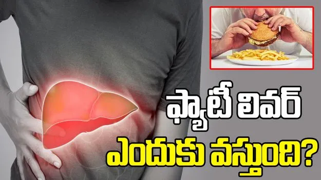 యువతలో పెరుగుతున్న ఫ్యాటీ లివర్.. కారణాలు తెలుసుకోండి