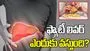 యువతలో పెరుగుతున్న ఫ్యాటీ లివర్.. కారణాలు తెలుసుకోండి