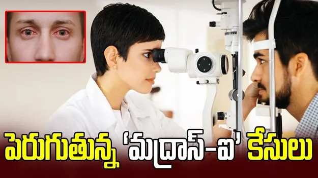 పెరుగుతున్న ‘మద్రాస్-ఐ’ కేసులు