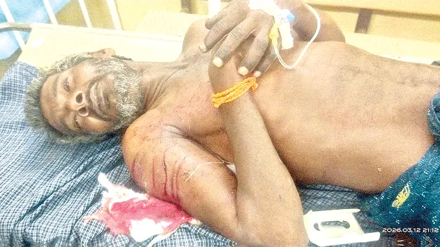 భర్తపై కత్తిపీటతో దాడి