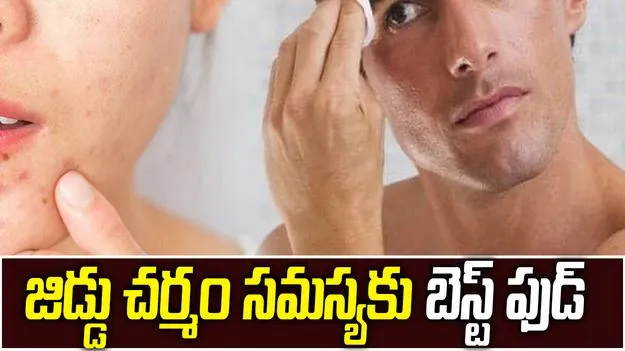 మీ ముఖం జిడ్డుగా మారుతోందా? వేసవిలో తీసుకోవాల్సిన జాగ్రత్తలు ఇవే!