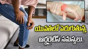 యువతలో పెరుగుతున్న ఆర్థరైటిస్ సమస్యలు.. కారణం ఇదేనా?