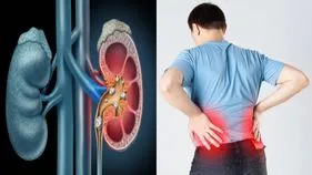 సైలెంట్ కిల్లర్.. లక్షణాలు లేకుండానే కమ్మేస్తున్న కిడ్నీ వ్యాధి