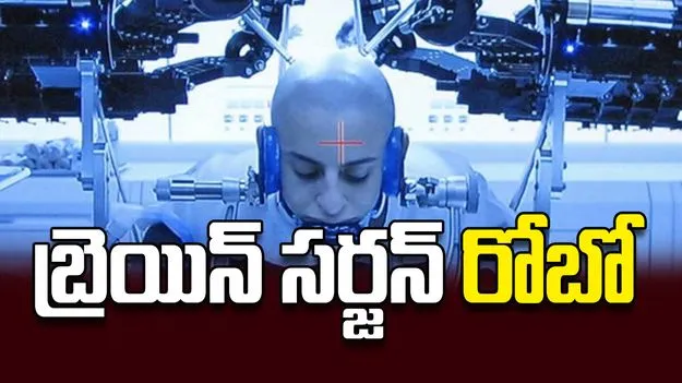 బ్రెయిన్‌ సర్జన్‌ రోబో