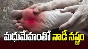 మధుమేహంతో నాడీ నష్టం