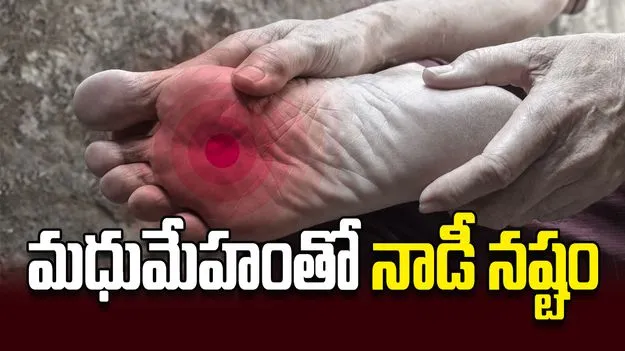 మధుమేహంతో నాడీ నష్టం