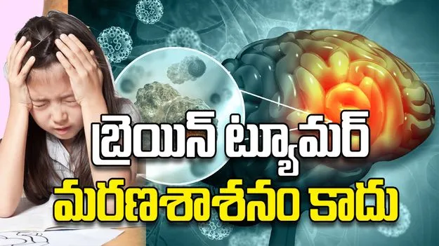  బ్రెయిన్‌ ట్యూమర్‌ మరణశాశనం కాదు