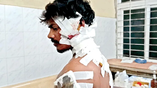 A teenager's horror attack యువకుడి భయానక దాడి