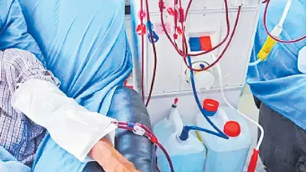 రాష్ట్రంలో కొత్తగా 79 డయాలసిస్‌ సెంటర్లు